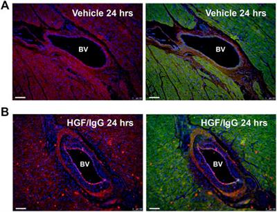 Human Growth Factor/Immunoglobulin Complexes for Treatment of Myocardial Ischemia-Reperfusion Injury